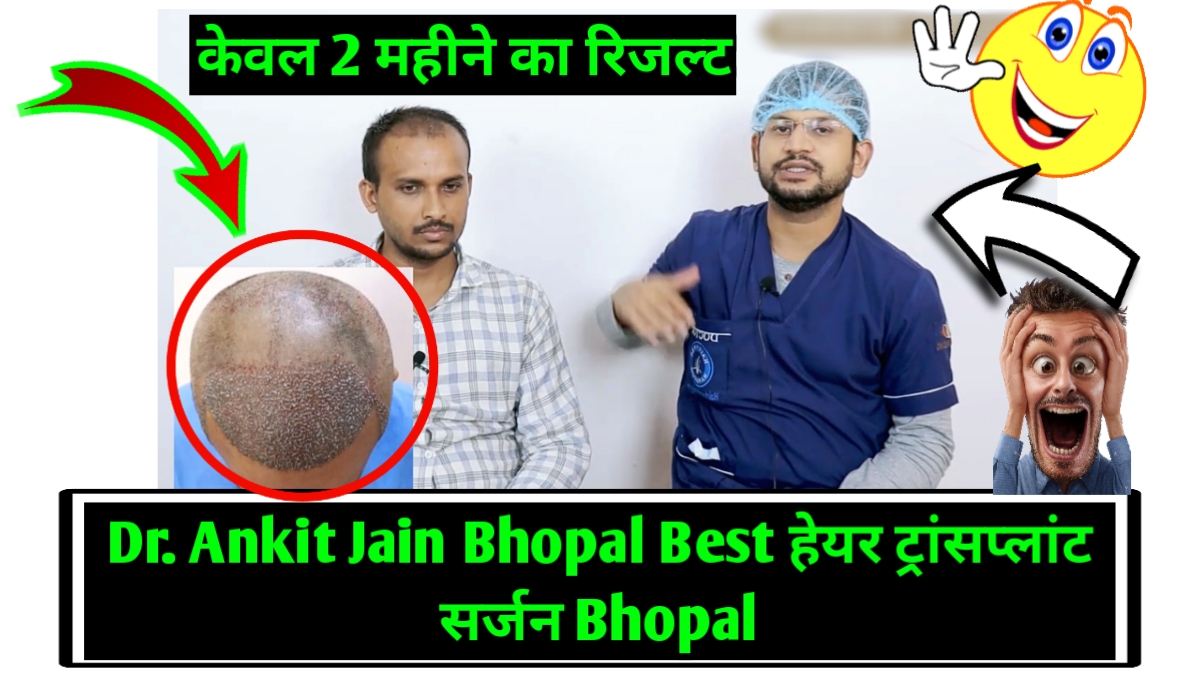 Best Hair Transplant in Bhopal 2022 Dr. Ankit Jain Bhopal हेयर ट्रांसप्लांट  सर्जन